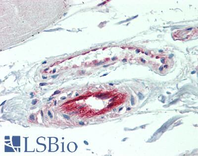 BST2 Antibody - Human Skeletal Muscle, Vessels: Formalin-Fixed, Paraffin-Embedded (FFPE)