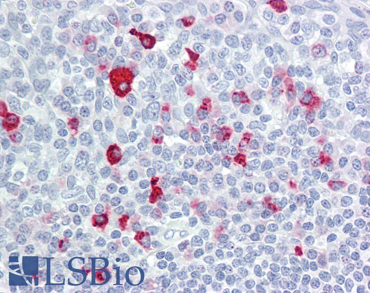 BTBD6 Antibody - Anti-BTBD6 antibody IHC of human tonsil. Immunohistochemistry of formalin-fixed, paraffin-embedded tissue after heat-induced antigen retrieval. Antibody dilution 5 ug/ml.