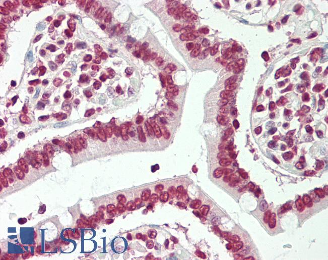 BTBD9 Antibody - Human Small Intestine: Formalin-Fixed, Paraffin-Embedded (FFPE)
