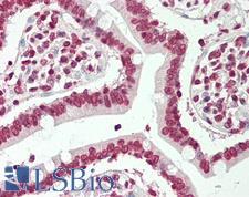 BTBD9 Antibody - Human Small Intestine: Formalin-Fixed, Paraffin-Embedded (FFPE)