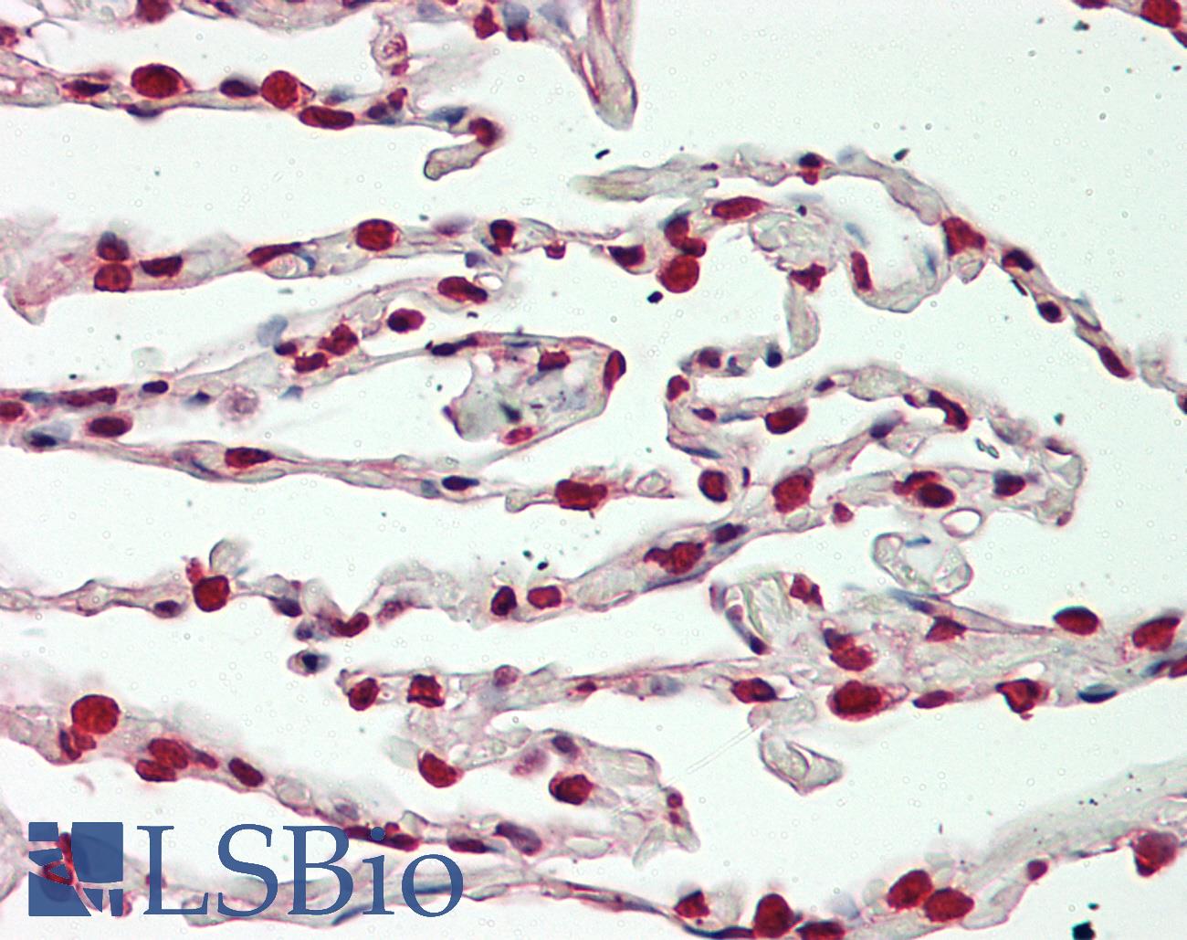 BTBD9 Antibody - Human Lung: Formalin-Fixed, Paraffin-Embedded (FFPE)