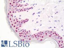 BTF / BCLAF1 Antibody - Anti-BTF / BCLAF1 antibody IHC staining of human skin. Immunohistochemistry of formalin-fixed, paraffin-embedded tissue after heat-induced antigen retrieval. Antibody dilution 1:100.