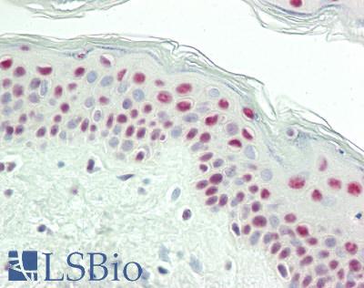BTF / BCLAF1 Antibody - Human Skin: Formalin-Fixed, Paraffin-Embedded (FFPE)