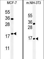 BTG1 Antibody - (LEFT)Western blot of BTG1 Antibody in MCF-7 cell line lysates (35 ug/lane). BTG1 (arrow) was detected using the purified antibody.(RIGHT)Western blot of BTG1 Antibody in mouse NIH-3T3 tissue lysates (35 ug/lane). BTG1 (arrow) was detected using the purified antibody.