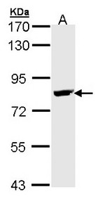 BTK Antibody - Sample (30 ug of whole cell lysate). A: Raji. 7.5% SDS PAGE. BTK antibody diluted at 1:5000. 