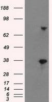 BTN3A2 Antibody - HEK293T cells were transfected with the pCMV6-ENTRY control (Left lane) or pCMV6-ENTRY BTN3A2 (Right lane) cDNA for 48 hrs and lysed. Equivalent amounts of cell lysates (5 ug per lane) were separated by SDS-PAGE and immunoblotted with anti-BTN3A2.