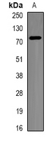 BTRCP / BETA-TRCP Antibody - Western blot analysis of beta-TrCP expression in BT474 (A) whole cell lysates.