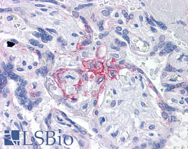 BUB1B / BubR1 Antibody - Anti-BUB1B / BubR1 antibody IHC of human placenta. Immunohistochemistry of formalin-fixed, paraffin-embedded tissue after heat-induced antigen retrieval. Antibody concentration 5 ug/ml.