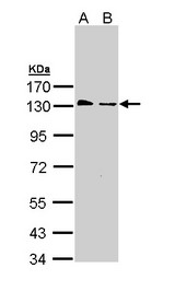 BUB1B / BubR1 Antibody - Sample (30 ug of whole cell lysate). A: A431. A: H1299. 7.5% SDS PAGE. BUB1B antibody diluted at 1:1000. 
