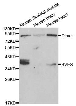 BVES Antibody - Western blot analysis of extracts of various cell lines, using BVES antibody at 1:1000 dilution. The secondary antibody used was an HRP Goat Anti-Rabbit IgG (H+L) at 1:10000 dilution. Lysates were loaded 25ug per lane and 3% nonfat dry milk in TBST was used for blocking.