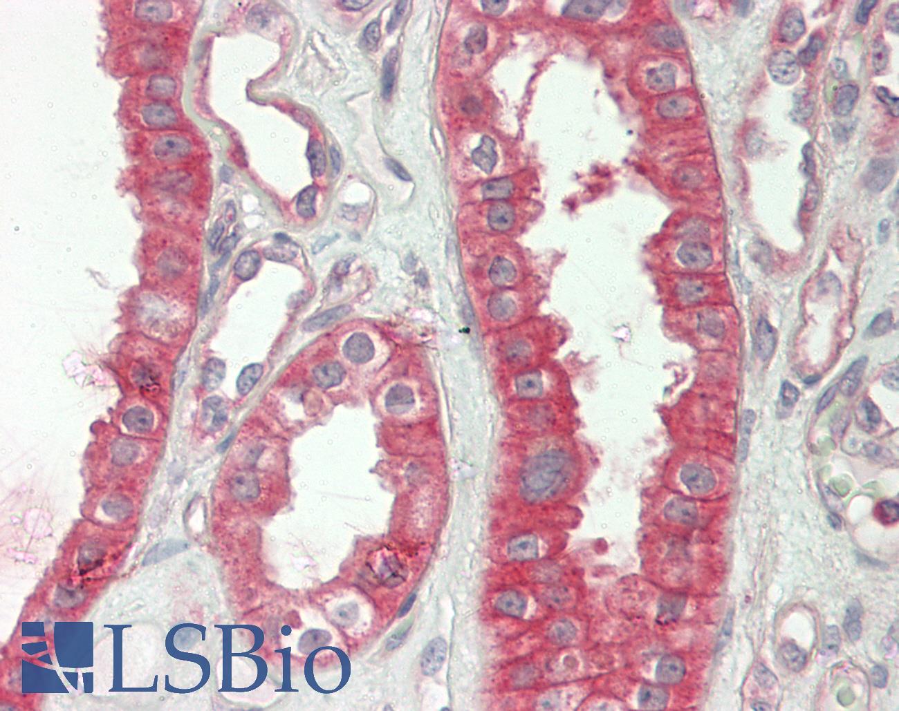 c-CBL Antibody - Human Kidney: Formalin-Fixed, Paraffin-Embedded (FFPE)