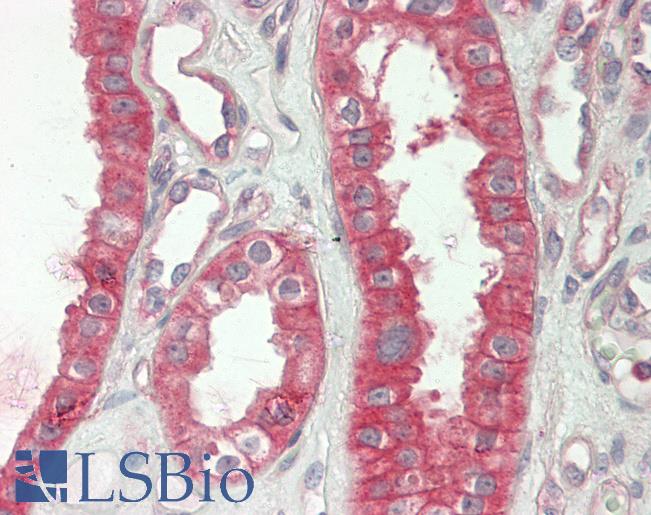 c-CBL Antibody - Human Kidney: Formalin-Fixed, Paraffin-Embedded (FFPE)