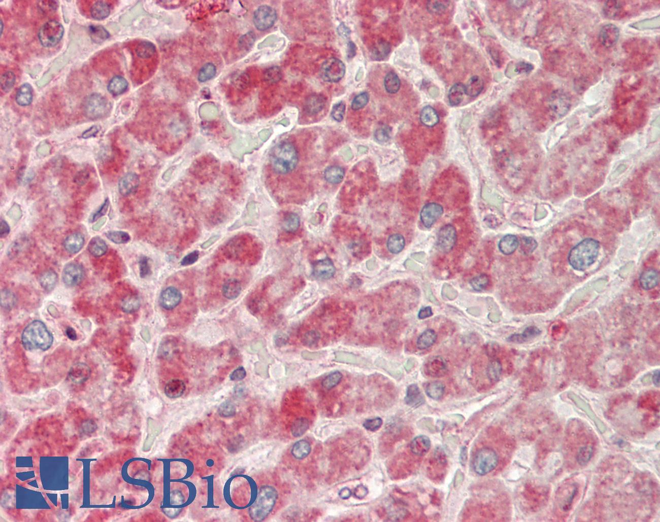 c-CBL Antibody - Human Liver: Formalin-Fixed, Paraffin-Embedded (FFPE)