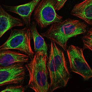 c-CBL Antibody - Immunofluorescence of HeLa cells using C-CBL mouse monoclonal antibody (green). Blue: DRAQ5 fluorescent DNA dye. Red: Actin filaments have been labeled with Alexa Fluor-555 phalloidin.