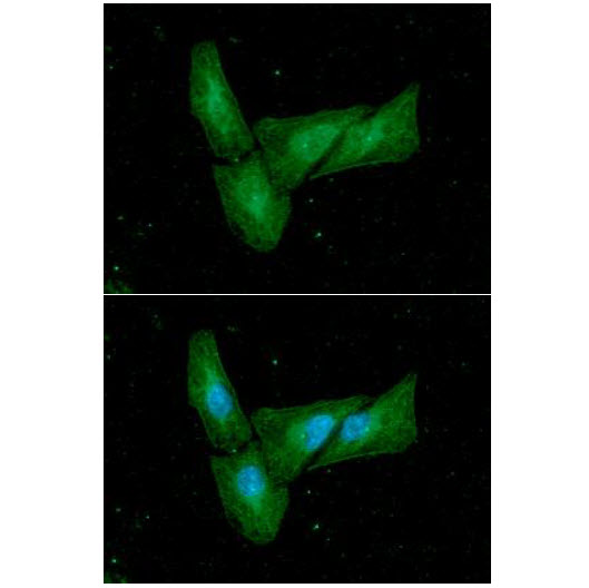 C/EBP Beta / CEBPB Antibody - ICC/IF analysis of C/EBP-?in HaLa cells. The cell was stained with C/EBP-Beta antibody (1:100). The secondary antibody (green) was used Alexa Fluor 488. DAPI was stained the cell nucleus (blue).