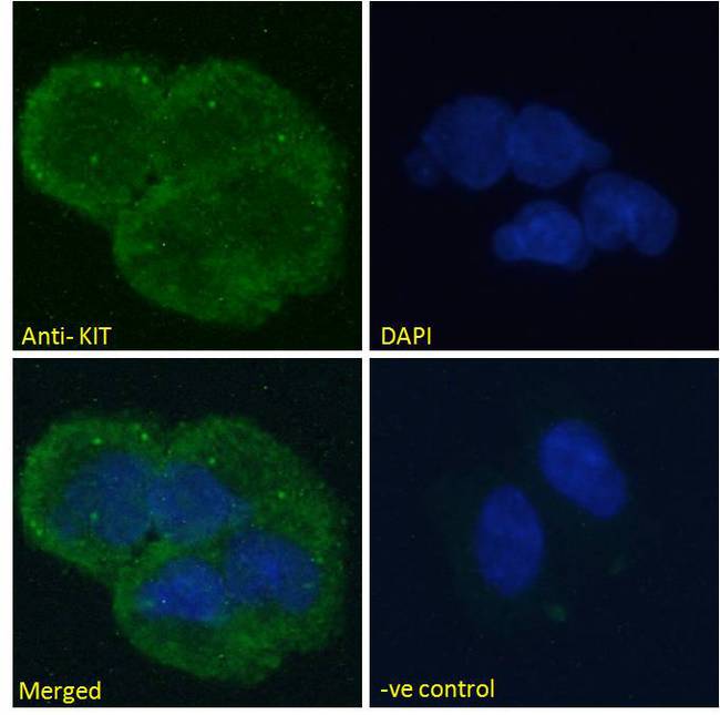 c-Kit / CD117 Antibody - Immunofluorescence analysis of paraformaldehyde fixed HEK293 cells, permeabilized with 0.15% Triton. Primary incubation 1hr (10ug/ml) followed by Alexa Fluor 488 secondary antibody (2ug/ml), showing cytoplasmic staining. The nuclear stain is DAPI (blue). Negative control: Unimmunized goat IgG (10ug/ml) followed by Alexa Fluor 488 secondary antibody (2ug/ml).