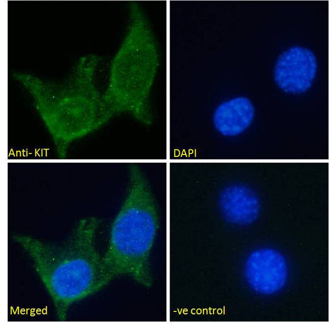 c-Kit / CD117 Antibody - Immunofluorescence analysis of paraformaldehyde fixed NIH3T3 cells, permeabilized with 0.15% Triton. Primary incubation 1hr (10ug/ml) followed by Alexa Fluor 488 secondary antibody (2ug/ml), showing membrane staining. The nuclear stain is DAPI (blue). Negative control: Unimmunized goat IgG (10ug/ml) followed by Alexa Fluor 488 secondary antibody (2ug/ml).