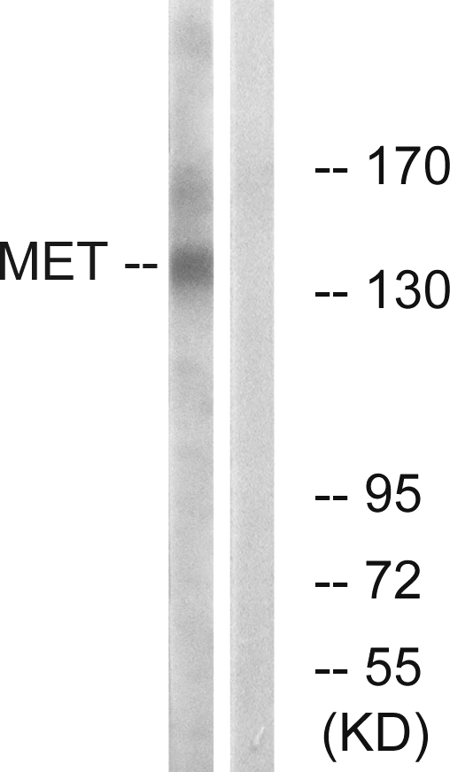 c-Met Antibody - Western blot analysis of lysates from HepG2 cells, using Met Antibody. The lane on the right is blocked with the synthesized peptide.
