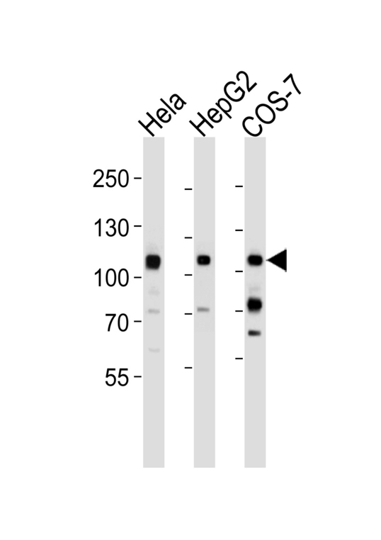 c-Met Antibody - Western blot of lysates from HeLa, HepG2, COS-7 cell line (from left to right), using MET/HGFR Antibody(4AT44). 4AT44 was diluted at 1:1000 at each lane. A goat anti-mouse IgG H&L (HRP) at 1:3000 dilution was used as the secondary antibody. Lysates at 35ug per lane.