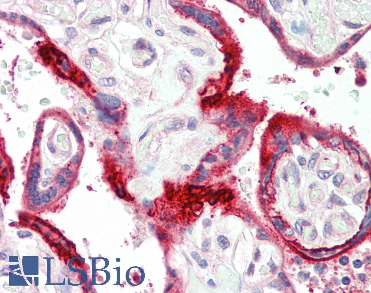 C11orf2 / Fat-Free Antibody - Anti-C11orf2 / Fat-Free antibody IHC staining of human placenta. Immunohistochemistry of formalin-fixed, paraffin-embedded tissue after heat-induced antigen retrieval.