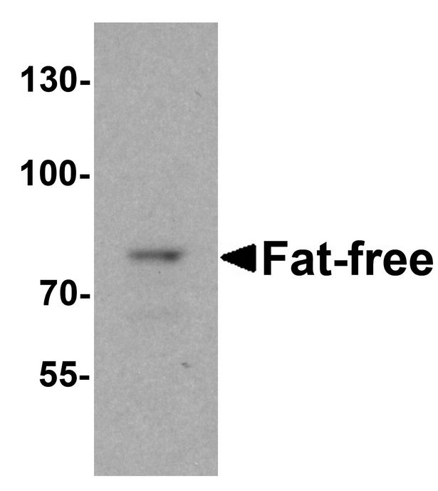 C11orf2 / Fat-Free Antibody - Western blot analysis of Fat Free in mouse brain tissue lysate with Fat Free antibody at 1 ug/ml.
