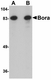 C13orf34 / BORA Antibody - Western blot of Bora in Jurkat cell lysate with Bora antibody at (A) 1 and (B) 2 ug/ml. 