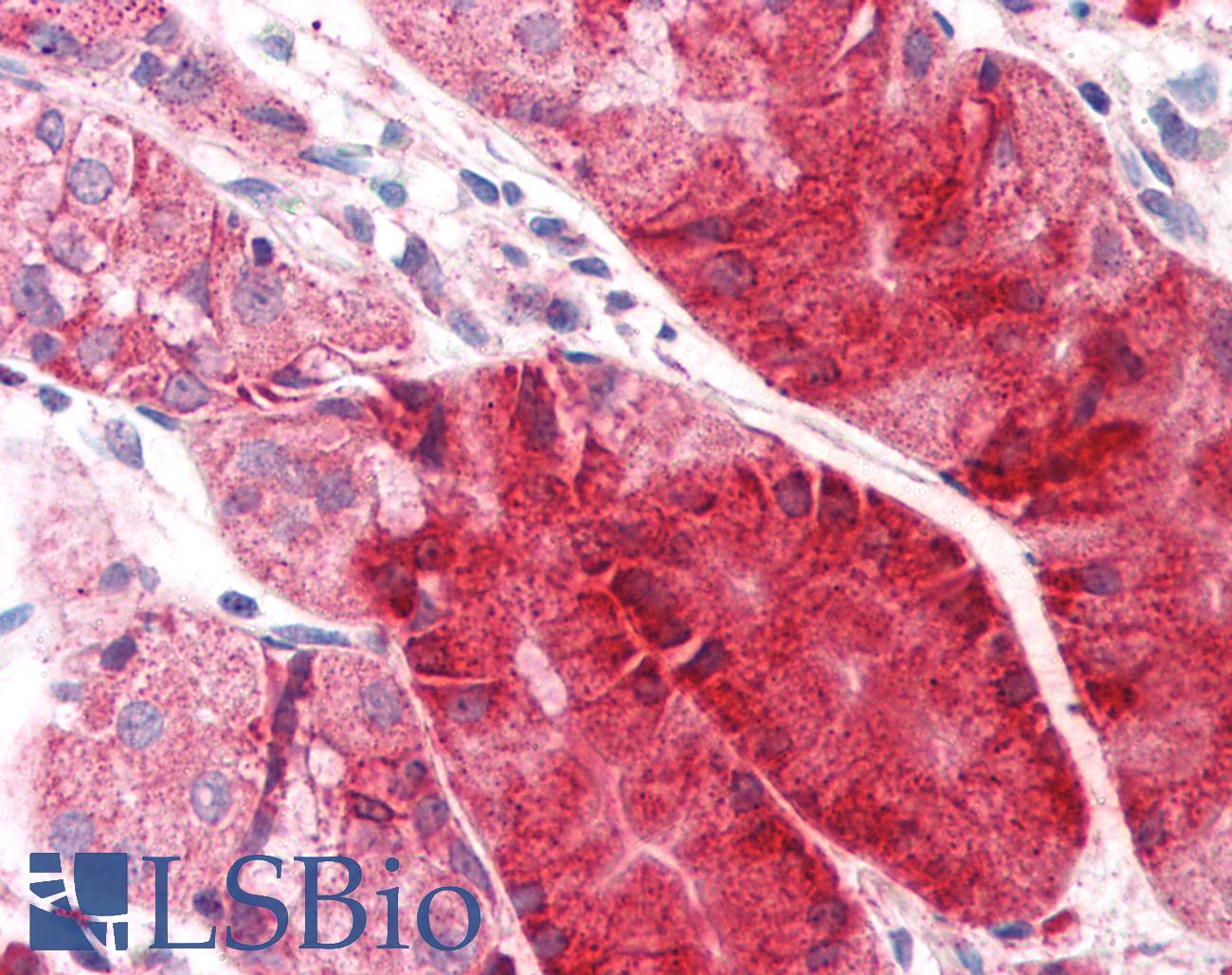 C14orf1 Antibody - Anti-C14orf1 antibody IHC of human stomach. Immunohistochemistry of formalin-fixed, paraffin-embedded tissue after heat-induced antigen retrieval.