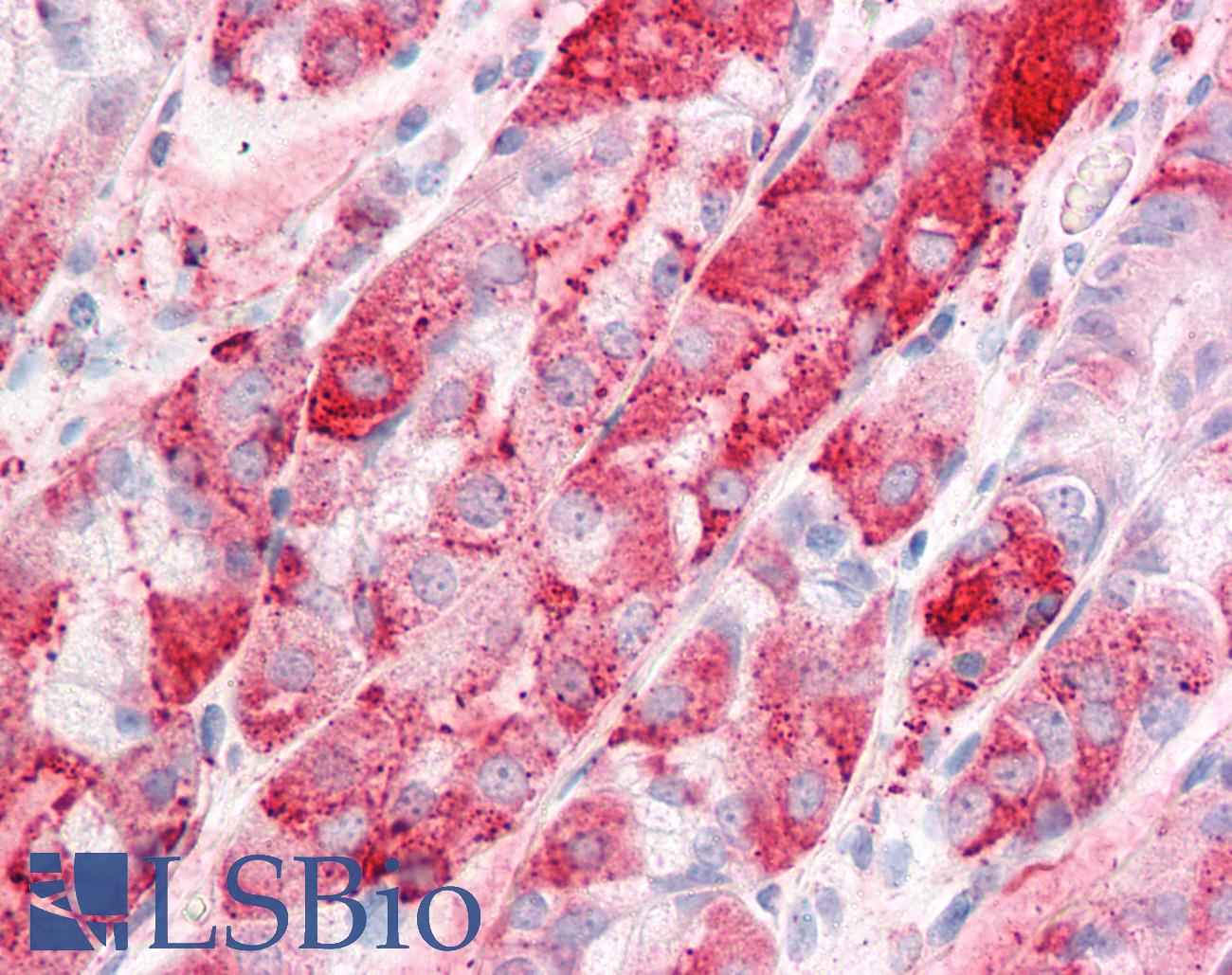 C14orf1 Antibody - Anti-C14orf1 antibody IHC of human stomach. Immunohistochemistry of formalin-fixed, paraffin-embedded tissue after heat-induced antigen retrieval.