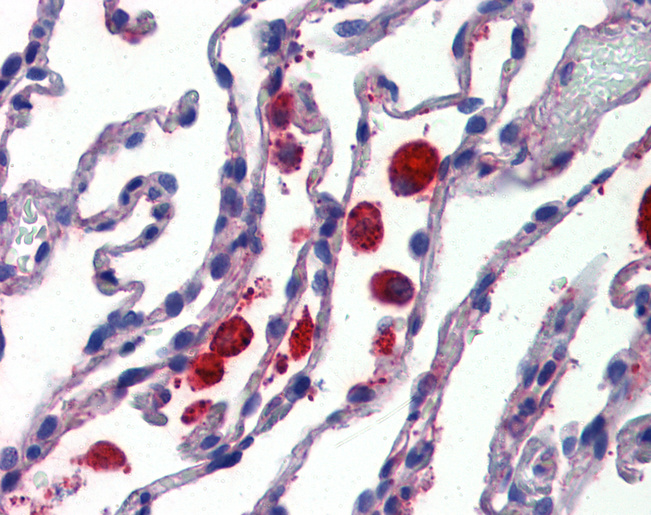 C14orf1 Antibody - Anti-C14orf1 antibody IHC of human lung. Immunohistochemistry of formalin-fixed, paraffin-embedded tissue after heat-induced antigen retrieval.