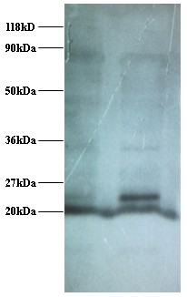 C14orf2 Antibody - Western blot of 6.8 kDa mitochondrial proteolipid antibody at 2 ug/ml. Lane 1: EC109 whole cell lysate. Lane 2: 293T whole cell lysate. Secondary: Goat polyclonal to Rabbit IgG at 1:15000 dilution. Predicted band size: 6.4 kDa. Observed band size: 20 kDa Additional bands at: 24 kDa. We are unsure as to the identity of this extra band.  This image was taken for the unconjugated form of this product. Other forms have not been tested.