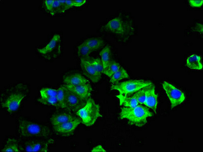 C14orf2 Antibody - Immunofluorescent analysis of MCF-7 cells using MP68 Antibody at dilution of 1:100 and Alexa Fluor 488-congugated AffiniPure Goat Anti-Rabbit IgG(H+L)
