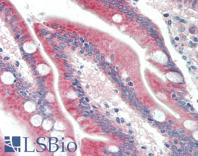 C18orf8 / MIC1; Antibody - Anti-C18orf8 antibody IHC staining of human small intestine. Immunohistochemistry of formalin-fixed, paraffin-embedded tissue after heat-induced antigen retrieval. Antibody concentration 5 ug/ml.
