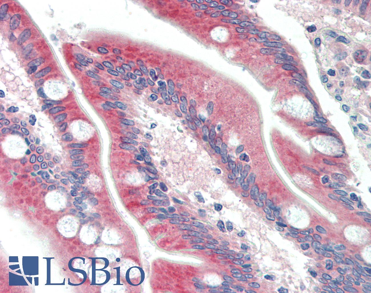 C18orf8 / MIC1; Antibody - Anti-C18orf8 antibody IHC staining of human small intestine. Immunohistochemistry of formalin-fixed, paraffin-embedded tissue after heat-induced antigen retrieval. Antibody concentration 5 ug/ml.
