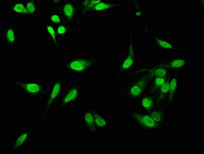 C1D Antibody - Immunofluorescence staining of Hela cells with C1D Antibody at 1:533, counter-stained with DAPI. The cells were fixed in 4% formaldehyde, permeabilized using 0.2% Triton X-100 and blocked in 10% normal Goat Serum. The cells were then incubated with the antibody overnight at 4°C. The secondary antibody was Alexa Fluor 488-congugated AffiniPure Goat Anti-Rabbit IgG(H+L).