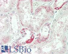 C1GALT1 Antibody - Human Kidney: Formalin-Fixed, Paraffin-Embedded (FFPE)