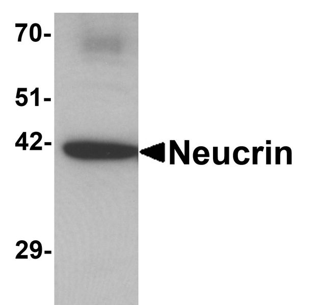 C1orf187 / DRAXIN Antibody - Western blot analysis of Neucrin in rat cerebellum tissue lysate with Neucrin antibody at 1 ug/ml.