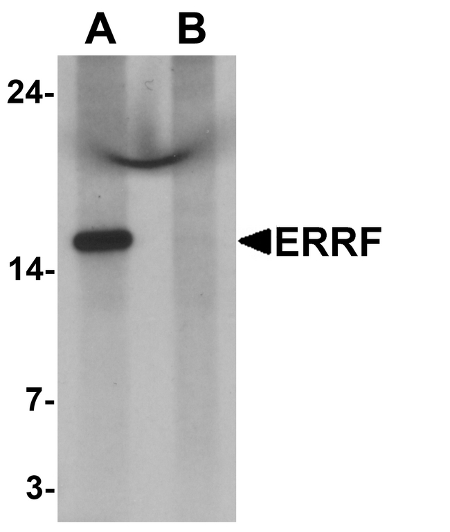 C1orf64 Antibody - Western blot analysis of C1orf64 in HeLa cell lysate with C1orf64 antibody at 1 ug/ml in (A) the absence and (B) the presence of blocking peptide.