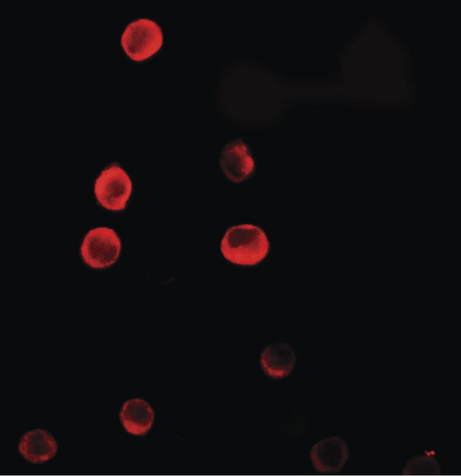 C1orf64 Antibody - Immunofluorescence of C1orf64 in HeLa cells with ERRF antibody at 20 ug/ml.