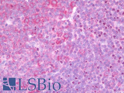 C1orf64 Antibody - Anti-C1orf64 antibody IHC staining of human tonsil. Immunohistochemistry of formalin-fixed, paraffin-embedded tissue after heat-induced antigen retrieval.