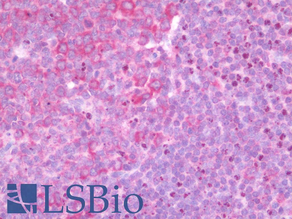 C1orf64 Antibody - Anti-C1orf64 antibody IHC staining of human tonsil. Immunohistochemistry of formalin-fixed, paraffin-embedded tissue after heat-induced antigen retrieval.