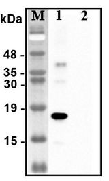C1QTNF1 / CTRP1 Antibody - Western blot analysis of recombinant human CTRPs using anti-CTRP1 (human), pAb at 1:4,000 dilution.1: Recombinant human CTRP1 protein (His-tagged).2: Unrelated recombinant protein (His-tagged).
