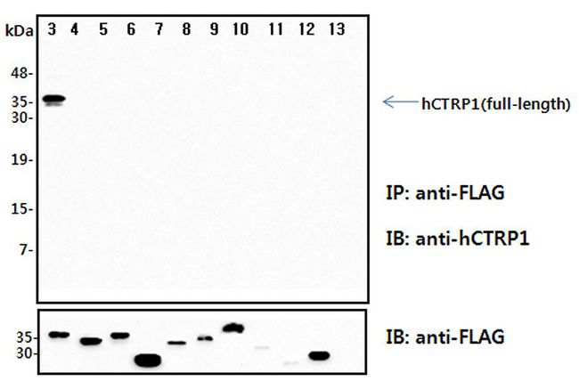C1QTNF1 / CTRP1 Antibody - Immunoprecipitation (IP) analysis of the cell lysates from HEK293 cells transfected with empty vector or a panel of the FLAG-tagged CTRP family (full-length) followed by immunoblot analysis using anti-CTRP1 (human), pAb at 1:4,000 dilution. The immunoblot (IB) analysis demonstrates the specificity of the anti-CTRP1 (human), pAb antibody. 3: hCTRP1-FLAG (full-length) transfected HEK293 cell lysates.. 4: hCTRP2-FLAG (full-length) transfected HEK293 cell lysates. 5: hCTRP3-FLAG (full-length) transfected HEK293 cell lysates. 6: hCTRP5-FLAG (full-length) transfected HEK293 cell lysates. 7: hCTRP6-FLAG (full-length) transfected HEK293 cell lysates. 8: hCTRP7-FLAG (full-length) transfected HEK293 cell lysates. 9: hCTRP9-FLAG (full-length) transfected HEK293 cell lysates. 10: hCTRP10-FLAG (full-length) transfected HEK293 cell lysates. 11: hCTRP11-FLAG (full-length) transfected HEK293 cell lysates. 12: hCTRP13-FLAG (full-length) transfected HEK293 cell lysates. 13: Empty vector transfected HEK293 cell lysates.