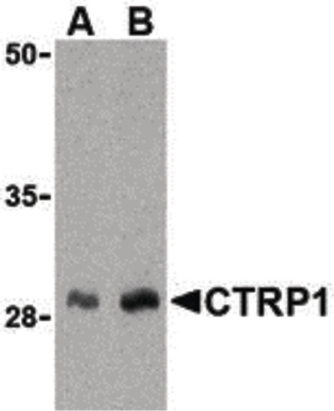 C1QTNF1 / CTRP1 Antibody - Western blot of CTRP1 in human kidney cell lysate with CTRP1 antibody at (A) 1 and (B) 2 ug/ml.