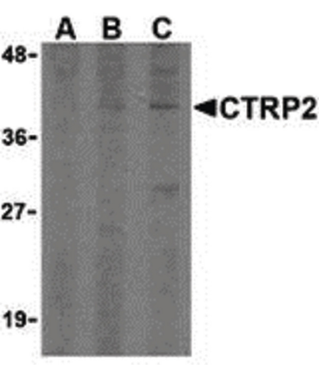 C1QTNF2 / CTRP2 Antibody - Western blot of CTRP2 in 3T3 (Balb) cell lysate with CTRP2 (IN) antibody at (A) 1, (B) 2, and (C) 4 ug/ml.
