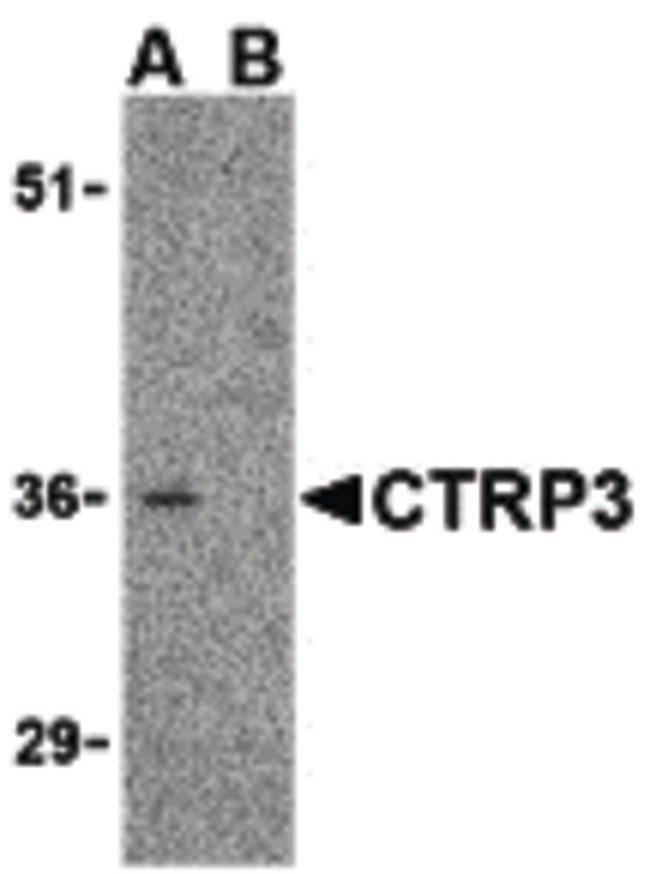 C1QTNF3 / CTRP3 Antibody - Western blot of CTRP3 in mouse heart cell lysate with CTRP3 antibody at 1 ug/ml in the (A) absence and (B) presence of blocking peptide.