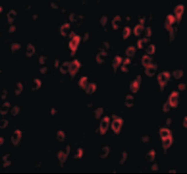 C1QTNF4 / CTRP4 Antibody - Immunofluorescence of CTRP4 in Rat Brain cells with CTRP4 antibody at 20 ug/ml.