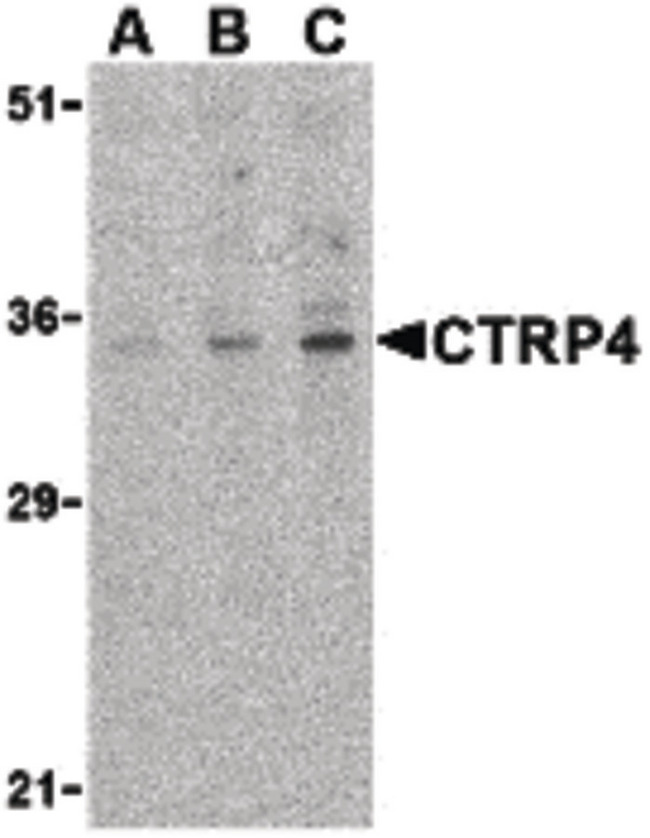 C1QTNF4 / CTRP4 Antibody - Western blot of CTRP4 in rat brain cell lysate with CTRP4 antibody at (A) 1, (B) 2, and (C) 4 ug/ml.