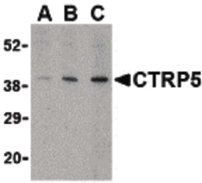 C1QTNF5 / CTRP5 Antibody - Western blot of CTRP5 in Caco-2 cell lysate with CTRP5 antibody at (A) 1, (B) 2, and (C) 4 ug/ml.
