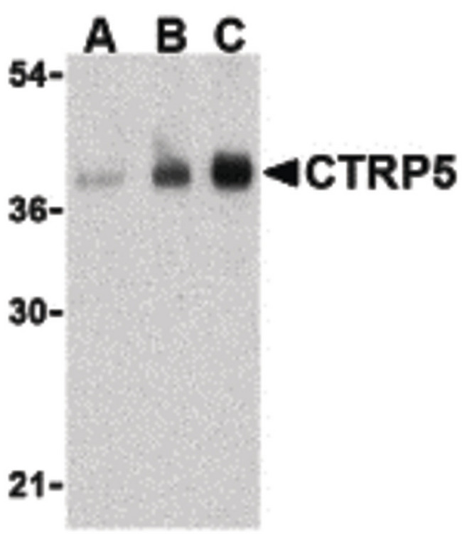 C1QTNF5 / CTRP5 Antibody - Western blot of CTRP5 in human brain cell lysate with CTRP5 antibody at (A) 1, (B) 2, and (C) 4 ug/ml.