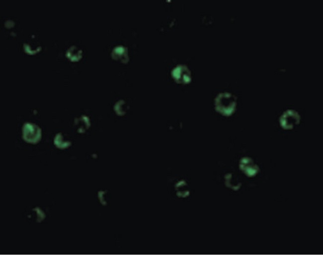 C1QTNF6 / CTRP6 Antibody - Immunofluorescence of CTRP6 in HeLa cells with CTRP6 antibody at 20 ug/ml.